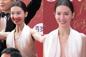 金晨整容后遗症明显：苹果肌夸张鼻子变形